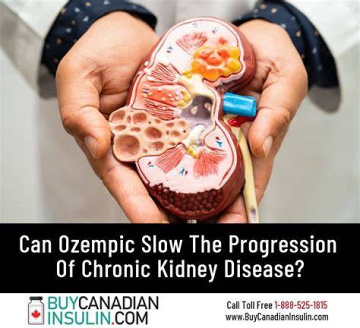 Can Ozempic Protect the Kidneys for People with Type 2 Diabetes